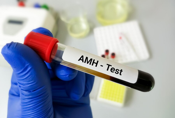 AMH Test